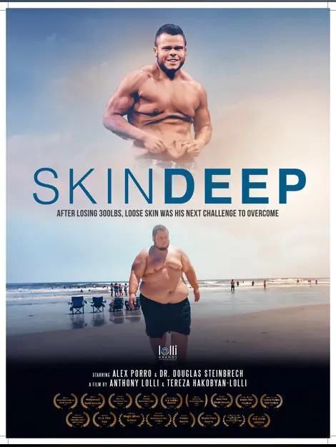 Skin Deep poster